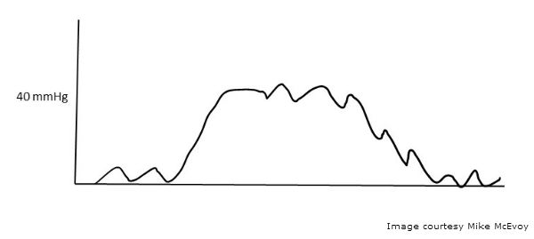 cardiogenic oscillations 