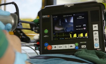 5 things to know about capnography