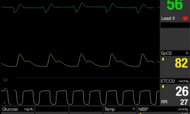 Reality Training: Patient is weak and dizzy