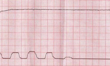 Rogue capno waves: Resuscitation team notes unusual waveform during CPR
