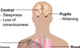 Capno 101: What is Opioid-induced Respiratory Depression?