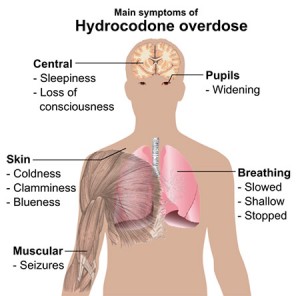 symptoms-hydrocodone-overdose