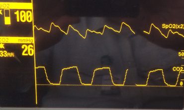 How capnography can be used to identify sepsis