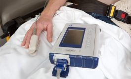 Quantitative and Qualitative Assessment of the Oxygen Delivery and EtCO2 Sampling During an Upper Endoscopy Procedure With the Oridion Smart Capnoline Guardian