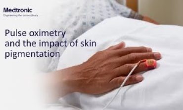Nellcor™ Pulse Oximetry Overview Pt.5: Impact of Skin Pigmentation on Pulse Oximetry Technology
