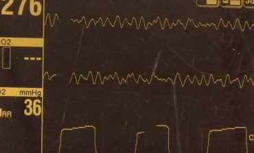 6 capnography monitor tips for capturing a clean waveform