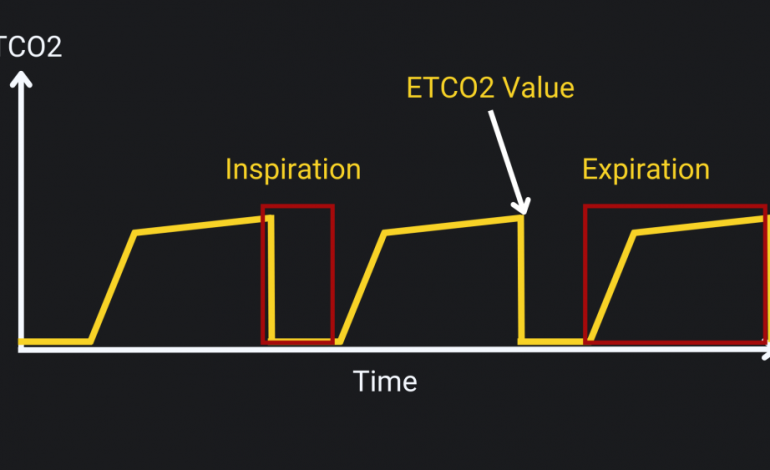 The critical role of capnography
