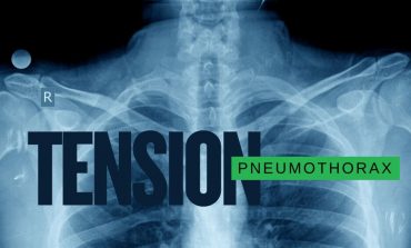 Tension pneumothorax: Needle decompression steps