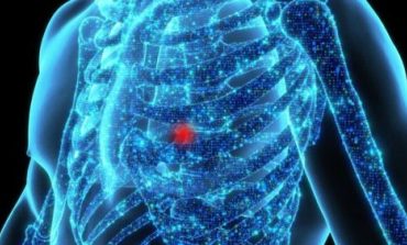 Recognizing pulmonary embolism: Key indicators